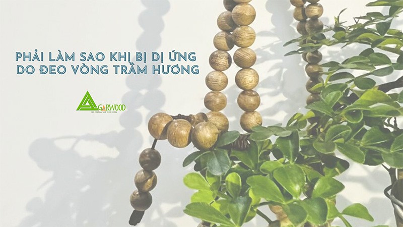 Phải làm sao khi bị dị ứng do đeo vòng trầm hương?